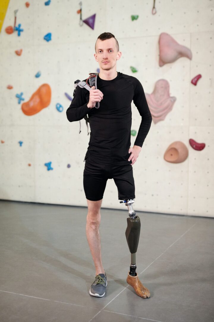 pexels-shotpot-4045762 A man with a leg cast and prosthetic arm.